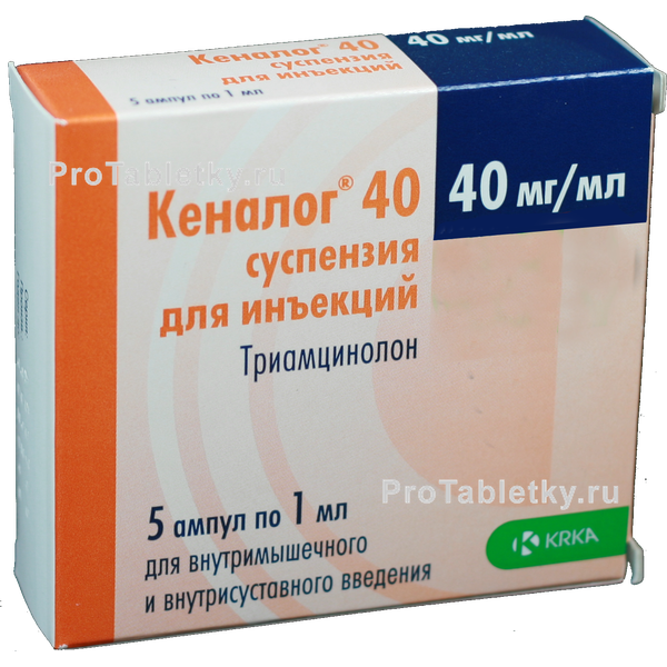 kenalog 40 za preglede bolova u zglobovima)