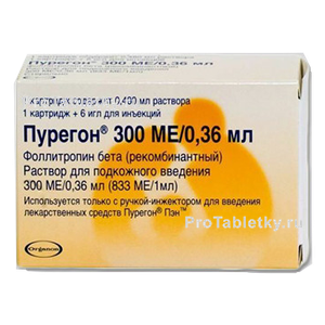 Фото пурегона